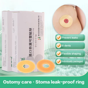 TDiepf 10Pc Anti-Leakage Ring For Colostomy Bag Ostomy Paste Ring Baseplates Stoma Care Products To Protect Skin