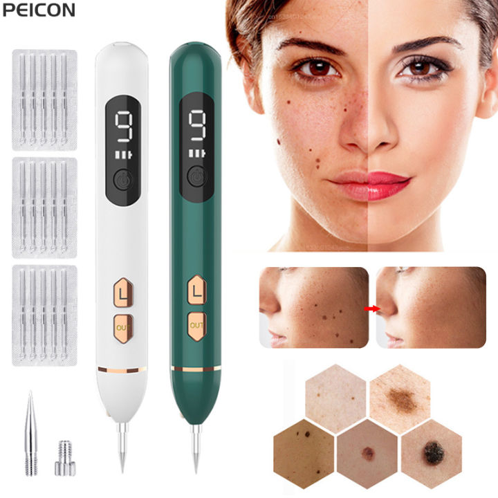 Laser Plasma Pen Black Dots Freckles Mole Wart Remover Pen Dark Spot ...