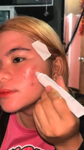 Azelaic acid 12% cream fades acne scars repairs acne brightens skin tone and controls oil 20g