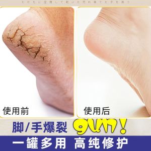 Vaseline Moisturizing Cream Anti-Cracking Chap Anti-Frost Essence Milk Brightening Refreshing And Non Greasy Skin Care Hand Cream foot cream 凡士林晶冻 40g