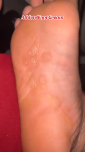 Foot Anti-Fungal Athletes Foot Cream Deodorant Cream Anti-Itch Odor Removing Beriberi Ointment Antibacterial 20g