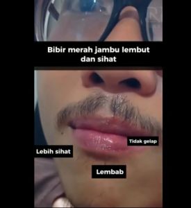 serum cerahkan bibir lelaki dan wanita / Raumen Lips Serum For man and woman