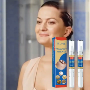 EELHOE Wart Remover Pen Krim Penghilang Lalat Krim Penghilang Kutil Mudah Dibawa Untuk Semua Kulit Krim Penghilang KutilWart Removal Cream