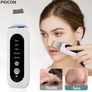 Siêu Âm Da Tẩy Lột Mụn Đầu Đen Tẩy Sâu Mặt Vệ Sinh Siêu Âm Ion Ance Lỗ Chân Lông Bụi Mặt Xẻng Sữa Rửa Mặt