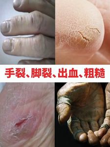Sangat pelembab krim pelembab perawatan tangan kaki Lotion kaki pecah-pecah Kering kaki krim Pecah pecah Kaki Krim anti keriput tangan