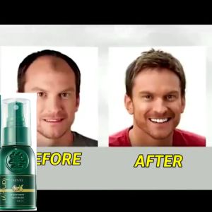 Anti-hair loss liquid Anti-dropping hair growth agent 30ml Hair growth spray Hair Tonic for Hair Growth Prevents Hair Loss Serum Improve hair follicles Nourishing Hair root Thinning Hair Treatment Spray Dense Hair Growth Tonic Serum for Man Woman