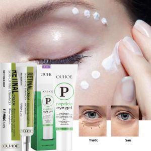 Kem Retinol Dành Cho Da Mặt 15g Chống Nhăn Làm Săn Chắc Dưỡng Ẩm Làm Mịn Da Rạng Rỡ - Chăm Sóc Da Chống Lão Hóa Từ Thực Vật Tự Nhiên