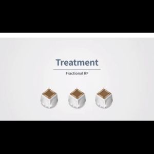 Đầu Fractional RF TIP 100 Pin   Dùng Cho Máy Thầm Mỹ Công Nghệ Cao 02 trong 01 Duet RF - Xuất xứ hãng EunSung (Korea)