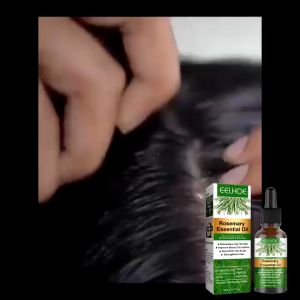 Ready Stock original rosemary Essential oil hair serum for hair growth serum rambut gugur hair tonic growth tonik rambut lebat pelebat rambut 頭發精油迷迭香