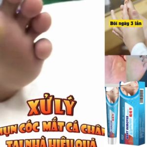 Gel tẩy nốt ruồi mụn thịt mục cóc an toàn hiệu quả nhanh chóng tẩy hết sạch nốt ruồi tàn nhan mụn cóc mụn thịt sẹo lồi trong vòng 3 ngày