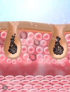 Sabun Pemutih Badan dan Wajah Viral Di Tiktok - SIMU Sabun Lumpur Vulkanik / Sabun Whitening Ampuh Memutihkan Badan dan Wajah - 220ml