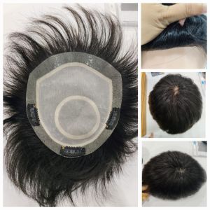 วิกผมชายติดกิฟติดกาว ปิดผมบางหัวล้านหัวเถิก ทอมือ ผมแท้100% ทรงซอยสั้น 16×18ซม