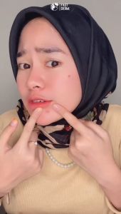 Fast Derm Serum Acne Dark Spot Perawatan Kulit Berjerawat