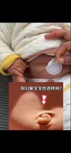 20Pcs Comfortable Baby Umbilical Hernia Patch/Disposable Umbilical Hernia Stickers/Baby Belly Button Stickers/Bath Prevent Infection Newborn Belly Button Protection/Hernia Pad.