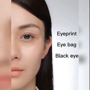 BUY 1 TAKE 1 Collagen Eye Cream Remove Eye Bags Dark Circles Anti Wrinkle Anti-Age Eye Care Essence 20g