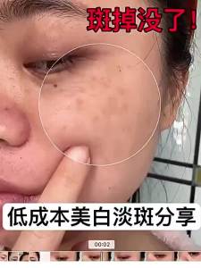 Gel Làm Sáng Da Niacinamide Chiết Xuất Bearberry