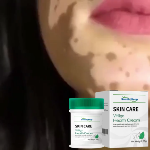 Obat Vitiligo Obat Penyakit Kulit Obat Bercak Putih Pada Kulit Obat Vitiligo di Wajah dan Lengan Obat Menghilangkan Vitiligo Obat Penghilang Vitiligo Obat Pemudar Bercak Putih di Tubuh Obat Salep Vitiligo Di Punggung