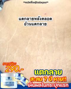 เสริมความมั่นใจและดูแลผิวหน้าใส อาร์บูตินเพียว ครีมกลูต้า ขาว ฟื้นฟูผิวกระจ่างใส ลดรอยเเตกลาย ขาหนีบดำ น้ำเหลืองไม่ดี หัวเข่าดำ สิวที่หลัง