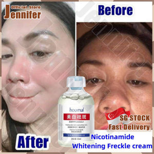 💥SG Stock💥 Dark spot serum / Niacinamide Anti freckles serum / Melasma whitening serum face brightening / Freckles removal serum / 美白祛斑