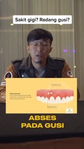 Obat Sakit Gigi Berlubang Paling Ampuh Penghilang Gusi Bengkak Linu Ngilu Anak Dewasa Pria Wanita