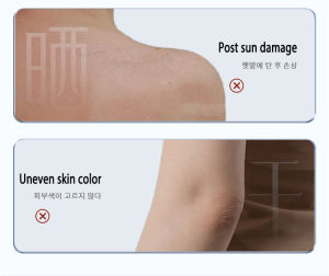 Post-Sun Recovery Cream - Rapid Brightening for Face & Neck Specifically formulated for sunburn repair after military training or sun exposure