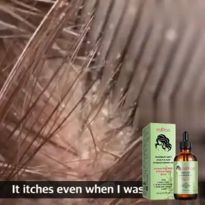 EELHOE Rosemary Oil Hair Strengthening Oil Rosemary Mint Scalp Fast Hair Growth Oil 60ml