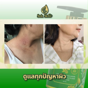 (1 ขวด) Sukskin Herbs สุขสกิน ครีมอาบน้ำสมุนไพร สูตรน้ำแร่ ฟองนุ่ม กลิ่นหอม สะอาด สดชื่น ขจัดคราบไคล ผิวกระจ่างใสเป็นธรรมชาติ พร้อมของแถม