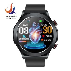 TK21P Smart Watch: A Comprehensive Guide to Blood Lipid, Uric Acid & Blood Glucose Monitoring