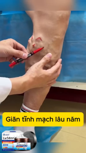 Kem Suy Giãn Tĩnh Mạch Nội Địa Nhật Bản SHIXENDO – Kem SHIXENDO Phục Hồi Tĩnh Mạch Cải Thiện Mao Mạch