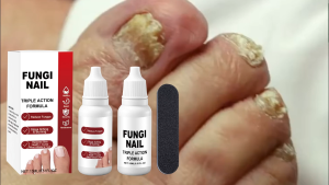 Fungal Nail Repair Serum – Nail Care Drops for Paronychia & Onychomycosis Hand & Foot Toe Infection Treatment Anti Fungal Fingernail Care