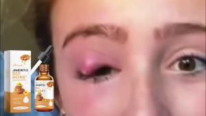 ximonth | Bee Honey Eye Drops Fatigue Dry Eyes Astigmatism Blurred Vision Reliever Refreshing Improve Eyesight Soothing Eye Care Products