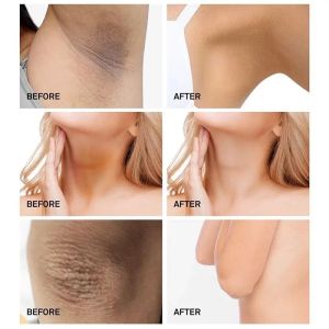 Private parts Whitening Cream Underarm Whitening Cream 60ml Underarms Armpits Thigh roots Whitening cream Whole body whitening Remove melanin deposits Whitening and smooth skin