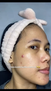 (SALE) LUMIWHITE Paket Brightening + Serum DNA Salmon [ Facewash + Toner + Day Cream + Night Cream + Retinol Essense + Serum DNA Salmon ]