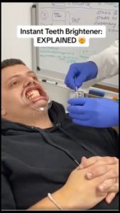 EELHOE V34 Teeth Whitening colour correct Teeth Whitening Teeth Stains Remove Stains Care Toothpaste Teeth Mouth Breathing Freshener Whitening Sensitive Teeth Toothpaste Teeth Colour Corrector Serum 30ml