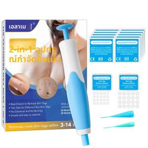 ชุดกำจัดติ่งเนื้อ 2-IN-1 แบบสองหัว สำหรับติ่งเนื้อขนาดเล็กถึงใหญ่ 2-8 มม. สายรัดกำจัดติ่งเนื้อที่ปลอดภัย พร้อมสำลีทำความสะอาด
