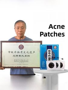 Wang Jiang Qin Shi Poison Removal Ointment Absorbing Pustule Patch Seating Board Infection Eliminating Pus Drawing Patch