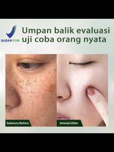 【BPOM】Lafaso Skin Barrier Moisturizing Gel - Ceramide Skin Barrier Repair Serum Moisturizer Emulsion 30ml For All Skin Types - Pelembab Wajah Pemutih-melembabkan kulit wajah kering - toner wajah skin conditioner-pelembab kulit kering wajah