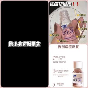 一点祛痘面霜祛痘修复缩毛孔去痘印去痘坑痘疤祛痘膏神器乳液 Little Acne Removal Cream Repair Shrink Pores Remove Marks Handy Tool Lotion