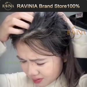 【RAVINIA】Anti dandruff scalp tonic extract 100g Powerful Dandruff Removal Itch Relief Folliculitis and Psoriasis Improvement Suitable