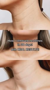 MEDIPEEL PREMIUM NAITE THREAD NECK CREAM [2.0 / UPGRADED] 100g (neck care reduce wrinkles necklines anti aging cream 护颈霜 脖子 皱纹 细纹 颈部皱纹 抗老霜 颈霜 Krim Leher)