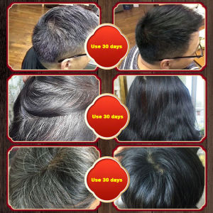 HSW【300ML】white hair to black hair shampoo organic polygonum multiflorum black hair shampoo white hair shampoo black shampoo for white hair organic white hair remover white hair turn to black hair All Natural And Organic Ingredients Improve hair follicl