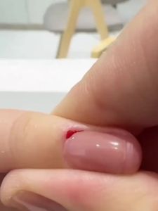 Dụng Cụ Cầm Máu Nghệ Thuật Móng Tay INFA-LAB 15ml Chất Liệu Nhựa Giúp Cầm Máu Nhanh Dùng Riêng Cho Tiệm Nail.
