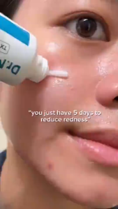 【SG Local Stock】Dr.Melaxin TX Cream 50ml | Dark Spot | Skin freckle Cream | Blemishes | Anti-Pigmetation