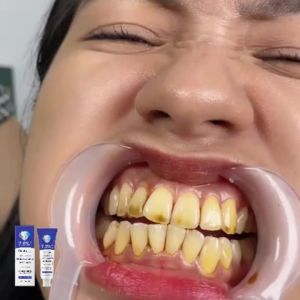 oralhoe | Hydroxyapatite Toothpaste Tooth Whiten Reduce Plaque Anti Decay Protect Teeth Dental Bleach Fresh Breath Gum Repair Toothpaste