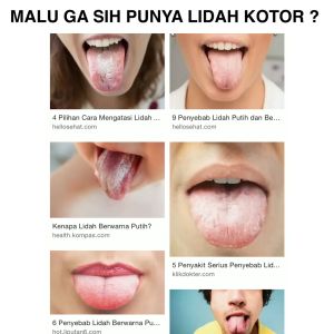 Sikat pembersih lidah sikat lidah pembersih lidah tongue cleaner SH AE21