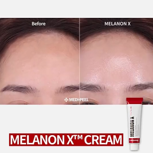 MediPeel Melanon X Dark Spots Pigmentation Meslama Jeragat Freckles Niacinamide Whitening Cream Medi-Peel