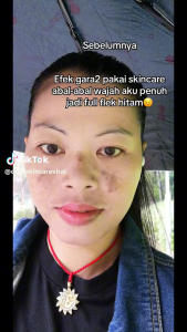 (HADIAH GRATIS) PAKET ORLIN BEAUTY SKINCARE / ORLIN BEAUTY / ORLIN / ORLIN SKINCARE / PUTIH GLOWING 10HARI