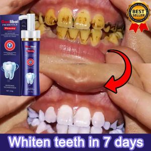 Whitening toothpaste Teeth Whitening Probiotic toothpaste 150g deep clean antibacterial toothpaste Fresh Breath Permanent teeth whitening