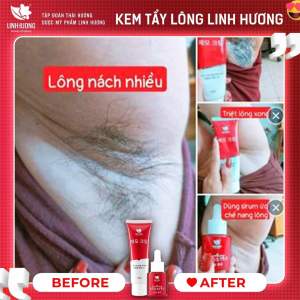Kem tẩy lông Linh Hương