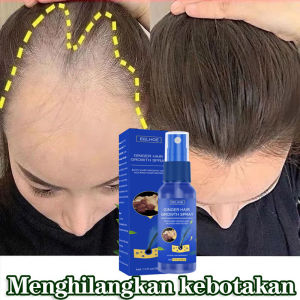 Hair Growth Spray: Solusi Penumbuh Rambut Botak & Anti Rontok